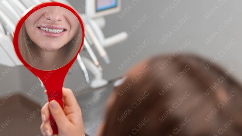 Hollywood smile Turkey preview